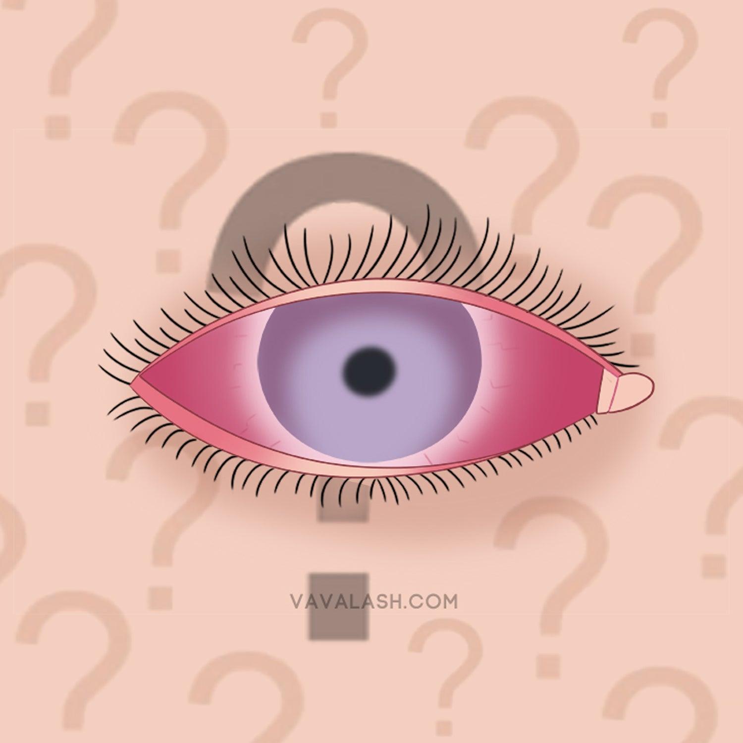How eyelash artists can avoid redness and swelling in the eyes after Grafting